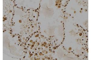 ABIN6264614 and ABIN6277485 at 1/100 staining Human lung tissue by IHC-P. (RAD23A antibody  (C-Term))