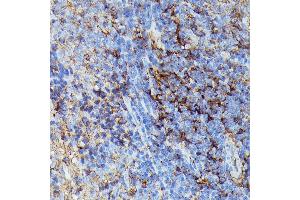 Immunohistochemistry (IHC) image for anti-Major Histocompatibility Complex, Class I, B (HLA-B) (AA 1-100) antibody (ABIN1513015)