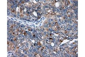 Immunohistochemical staining of paraffin-embedded Kidney tissue using anti-SIL1 mouse monoclonal antibody.