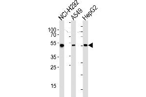 Western blot analysis of lysates from NCI-, A549, HepG2 cell line (from left to right), using ALDH2 Antibody (ABIN658993 and ABIN2838036). (ALDH2 antibody)
