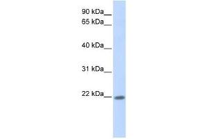 Western Blot showing ZNF534 antibody used at a concentration of 1-2 ug/ml to detect its target protein.