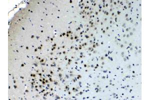 IHC analysis of CHAT using anti- CHAT antibody . (Choline Acetyltransferase antibody  (AA 446-652))