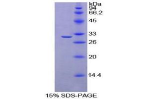 SDS-PAGE (SDS) image for Ribonuclease/angiogenin Inhibitor 1 (RNH1) (AA 108-358) protein (His tag) (ABIN1879328)