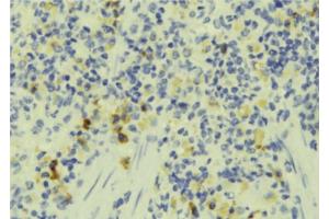 ABIN6273242 at 1/100 staining Human lymph tissue by IHC-P. (FAM65B antibody)
