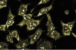 Immunofluorescence staining of HeLa cells (Human cervical epitheloid carcinoma, ATCC CCL-2. (BDKRB2 antibody  (AA 350-364))