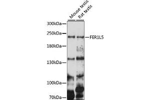 Western blot analysis of extracts of various cell lines, using FER1L5 antibody (ABIN7267166) at 1000 dilution. (FER1L5 antibody  (AA 1350-1670))