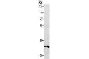 Western Blotting (WB) image for anti-Interleukin 1 Receptor-Like 1 (IL1RL1) antibody (ABIN2422347) (IL1RL1 antibody)