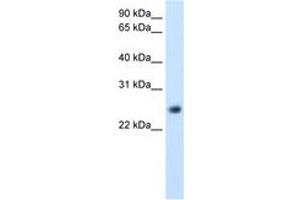 Image no. 2 for anti-gamma-Glutamyltransferase Light Chain 1 (GGTLC1) (C-Term) antibody (ABIN204972) (GGTLC1 antibody  (C-Term))