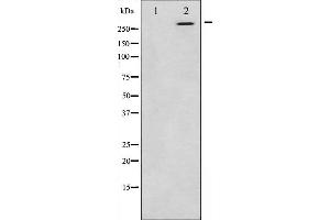 CEP290 antibody  (Internal Region)