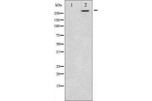 CEP290 antibody  (Internal Region)