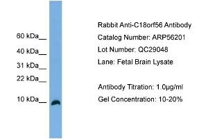 WB Suggested Anti-C18orf56  Antibody Titration: 0. (C18orf56 antibody  (N-Term))