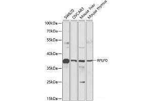 Western blot analysis of extracts of various cell lines using RPLP0 Polyclonal Antibody at dilution of 1:1000. (RPLP0 antibody)