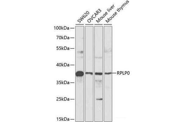 RPLP0 anticorps