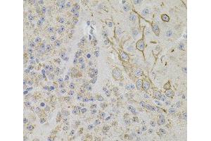Immunohistochemistry of paraffin-embedded Mouse brain using REG3A Polyclonal Antibody (REG3A antibody)