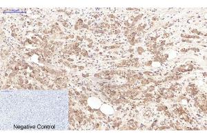 Immunohistochemistry (IHC) image for anti-Lactotransferrin (LTF) antibody (ABIN5960745) (Lactoferrin antibody)