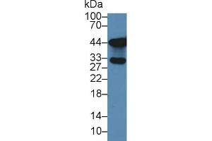 Western blot analysis of Human Lung lysate, using Human TKA1 Antibody (3 µg/ml) and HRP-conjugated Goat Anti-Rabbit antibody (