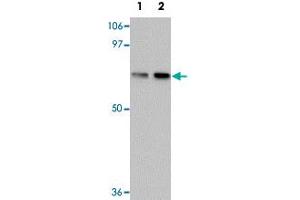 Western blot analysis of TCTN1 in mouse kidney tissue lysate with TCTN1 polyclonal antibody  at (1) 1 and (2) 2ug/mL. (TCTN1 antibody  (N-Term))