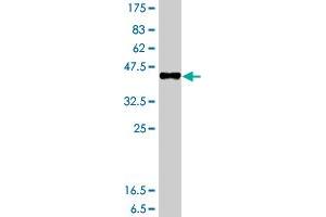 Western Blot detection against Immunogen (37. (GTSE1 antibody  (AA 621-720))