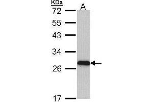 WB Image Sample (30 ug of whole cell lysate) A: Molt-4 , 12% SDS PAGE antibody diluted at 1:1000 (MYL3/CMLC1 antibody)