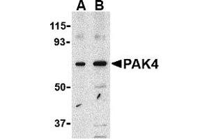 Western Blotting (WB) image for anti-P21-Activated Kinase 4 (PAK4) (Middle Region) antibody (ABIN1031030) (PAK4 antibody  (Middle Region))