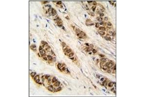 Image no. 2 for anti-DCTP Pyrophosphatase 1 (DCTPP1) (N-Term) antibody (ABIN357989) (DCTPP1 antibody  (N-Term))