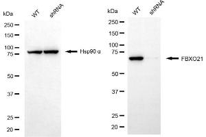 Western blotting analysis using FBXO21 antibody (ABIN7798554). (FBXO21 antibody)