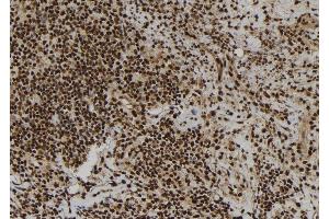 ABIN6277252 at 1/100 staining Human spleen tissue by IHC-P.
