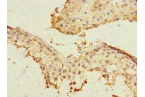 Immunohistochemistry of paraffin-embedded human testis tissue using ABIN7169162 at dilution of 1:100 (PLK3 antibody  (AA 487-646))