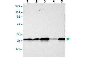 Western blot analysis of lane 1: RT-4, lane 2: U-251 MG, lane 3: A-431, lane 4: Liver and lane 5: Tonsil using SNAP23 polyclonal antibody .