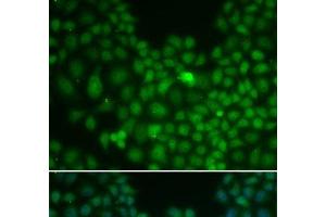 Immunofluorescence analysis of U2OS cells using CLU Polyclonal Antibody (Clusterin antibody)