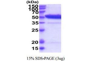 SDS-PAGE (SDS) image for Tubulointerstitial Nephritis Antigen-Like 1 (TINAGL1) (AA 22-467) protein (His tag) (ABIN6388025)
