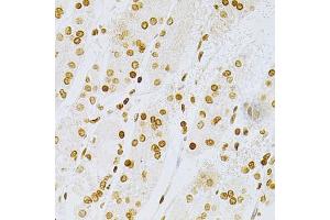 Immunohistochemistry of paraffin-embedded human stomach using DKC1 Antibody (ABIN5970956) at dilution of 1/200 (40x lens). (DKC1 antibody)