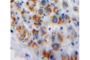 #VALUE! (GP5 antibody  (AA 246-485))