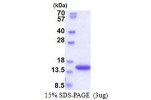SDS-PAGE (SDS) image for Synaptojanin 2 Binding Protein (SYNJ2BP) (AA 1-117) protein (His tag) (ABIN5778865) (SYNJ2BP Protein (AA 1-117) (His tag))