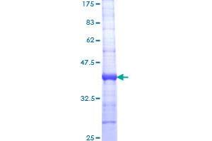 IDE Protein (AA 920-1019) (GST tag)