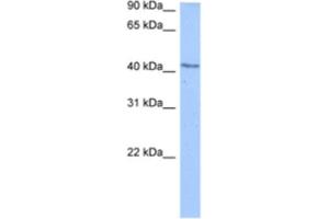 Western Blotting (WB) image for anti-DCP2 Decapping Enzyme Homolog (DCP2) antibody (ABIN2462345) (DCP2 antibody)