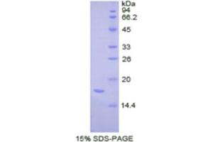 SDS-PAGE analysis of Human Complexin 2 Protein. (CPLX2 Protein)