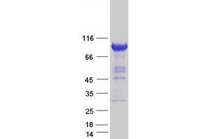 Validation with Western Blot (ZW10 Protein (Myc-DYKDDDDK Tag))