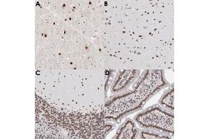 Immunohistochemical staining (Formalin-fixed paraffin-embedded sections) of human cerebral cortex (A, B), human cerebellum (C) and human duodenum (D) with ZNF3 polyclonal antibody .