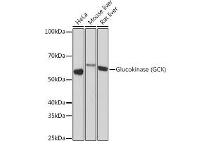 Western blot analysis of extracts of various cell lines, using Glucokinase (GCK) (GCK) Rabbit mAb (ABIN7267396) at 1:1000 dilution. (GCK antibody)