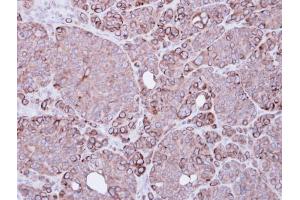 IHC-P Image Immunohistochemical analysis of paraffin-embedded SW480 xenograft, using BIRC4, antibody at 1:500 dilution. (XIAP antibody  (C-Term))