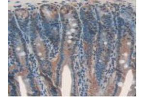 IHC-P analysis of Rat Intestine Tissue, with DAB staining. (IL17RD antibody  (AA 356-605))