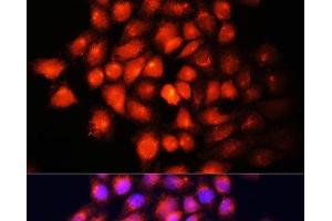 Immunofluorescence analysis of HeLa cells using IGF2 Polyclonal Antibody at dilution of 1:100 (40x lens). (IGF2 antibody)