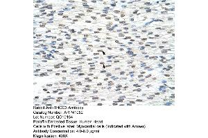 Rabbit Anti-THOC3 Antibody  Paraffin Embedded Tissue: Human Heart Cellular Data: Myocardial cells Antibody Concentration: 4. (THO Complex 3 antibody  (Middle Region))