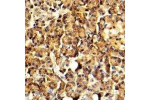 Immunohistochemical analysis of Arylsulfatase G staining in human pancreas formalin fixed paraffin embedded tissue section. (ARSG antibody)