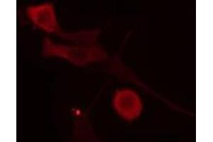 ABIN6275999 staining  COLO205 cells by IF/ICC. (Glucagon Receptor antibody  (Internal Region))