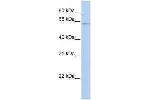WB Suggested Anti-SOX30 Antibody Titration:  0. (SOX30 antibody  (Middle Region))