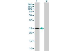 Western Blot analysis of GSTZ1 expression in transfected 293T cell line by GSTZ1 MaxPab polyclonal antibody. (GSTZ1 antibody  (AA 1-216))