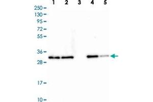Western blot analysis of Lane 1: Human cell line RT-4 Lane 2: Human cell line U-251MG Lane 3: Human plasma Lane 4: Human liver tissue Lane 5: Human tonsil tissue with CLTA polyclonal antibody  at 1:250-1:500 dilution. (CLTA antibody)