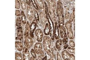 Immunohistochemical staining of human kidney with WDR23 polyclonal antibody  shows moderate to strong positivity in tubular cells at 1:20-1:50 dilution.
